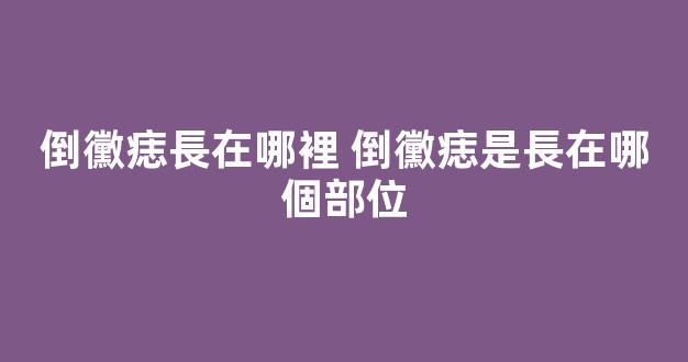 倒黴痣長在哪裡 倒黴痣是長在哪個部位